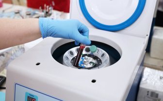 Persoon stopt buisje met bloed in centrifuge apparaat