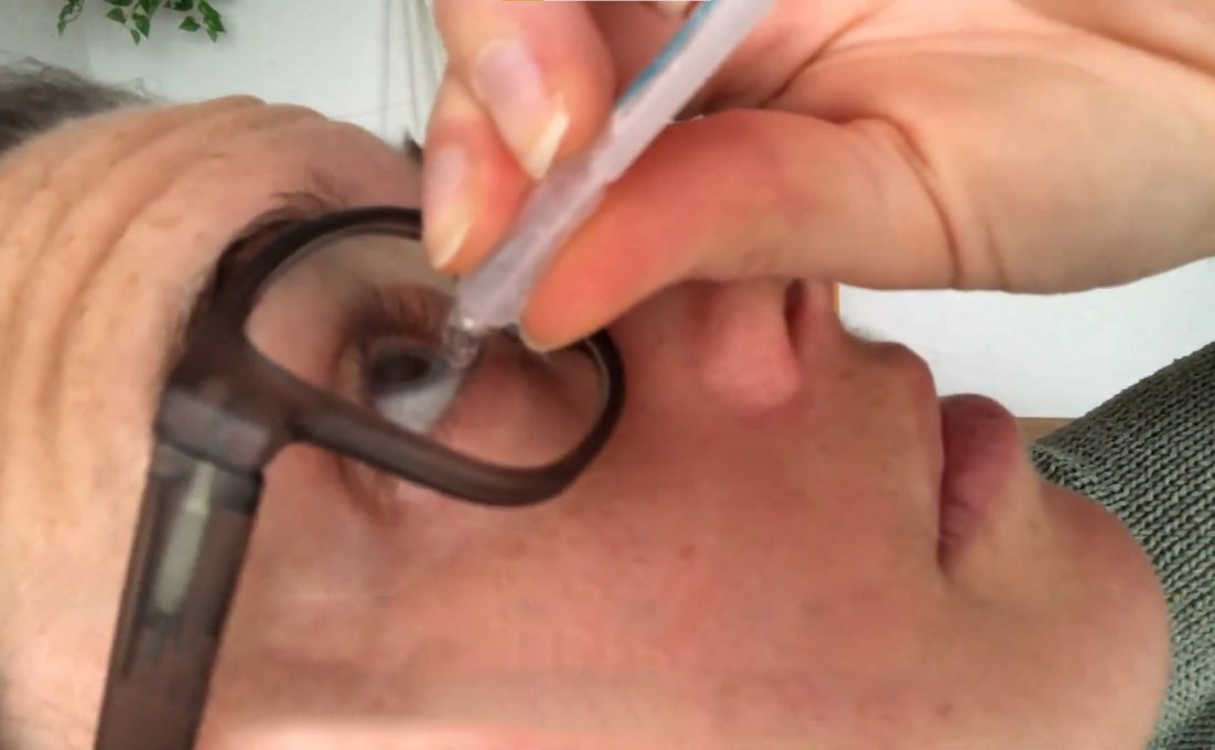 Vrouw druppelt in haar oog met druppelbril